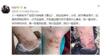 毒虫的图片,惊悚瞬间捕捉毒虫瞬间